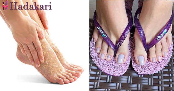 යටි පතුල්  වේදනා වලට සත්කාර කරන ගමන් ලස්සන දෙපා වල හිමිකාරිණියක් වෙන්න | Heal your feet while making them pretty