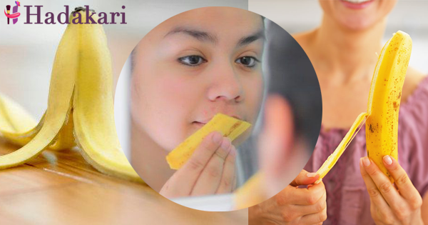 කුරුලෑ වලට ප්‍රතිකාර කිරීම සඳහා කෙසෙල් ලෙල්ල භාවිතා කිරීමට සරල ක්‍රම 5ක් | 5 ways to fight acne with banana peel