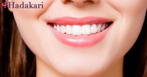 දත් සුදු කර ගැනීමට ඔයාට උපකාරී වන සරල උපක්‍රම | Tricks to make your teeth look white
